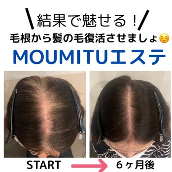 続々と「結果」出てます！MOUMITUエステ★