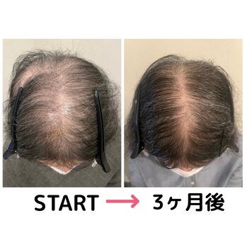 続々と「結果」出てます！MOUMITUエステ★