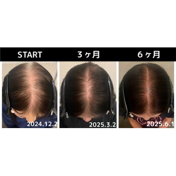 続々と「結果」出てます！MOUMITUエステ★
